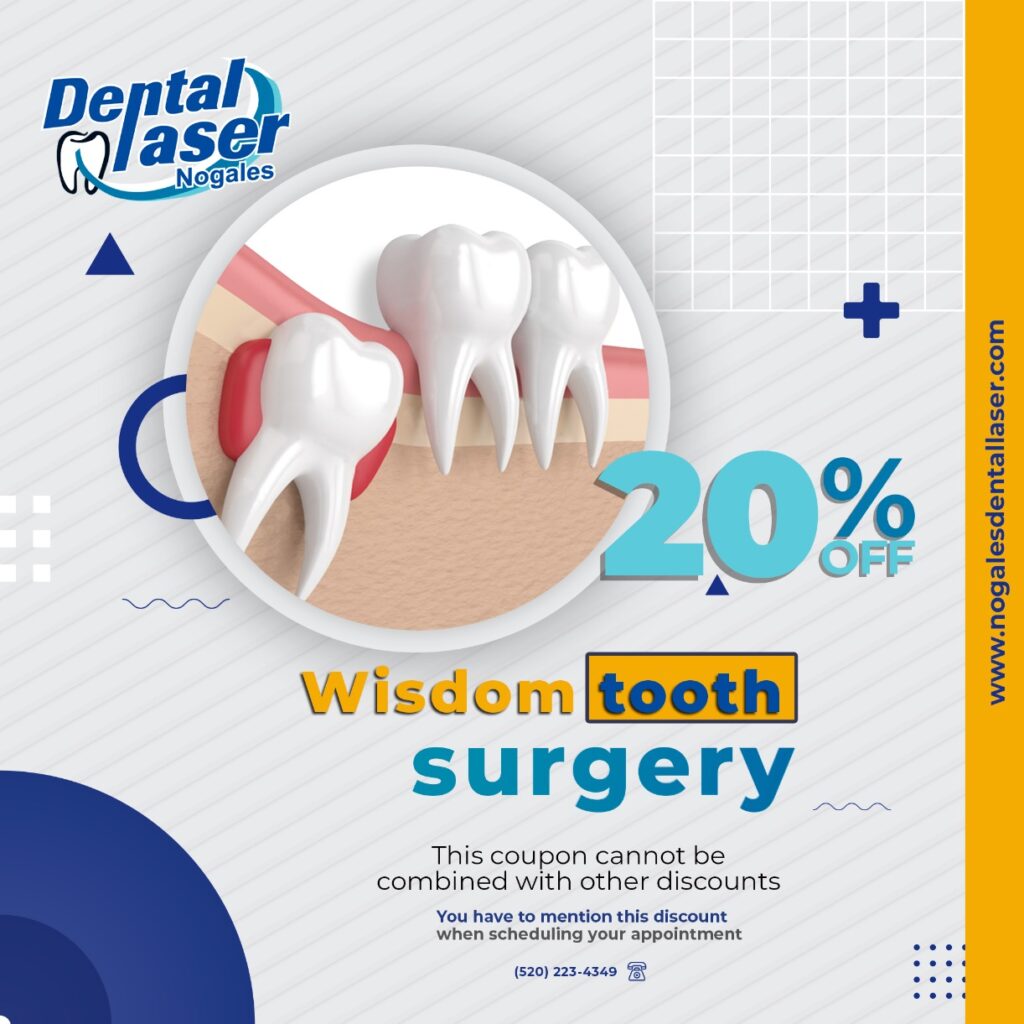 deals-on-wisdom-tooth-removal-1 - Dental Laser Nogales