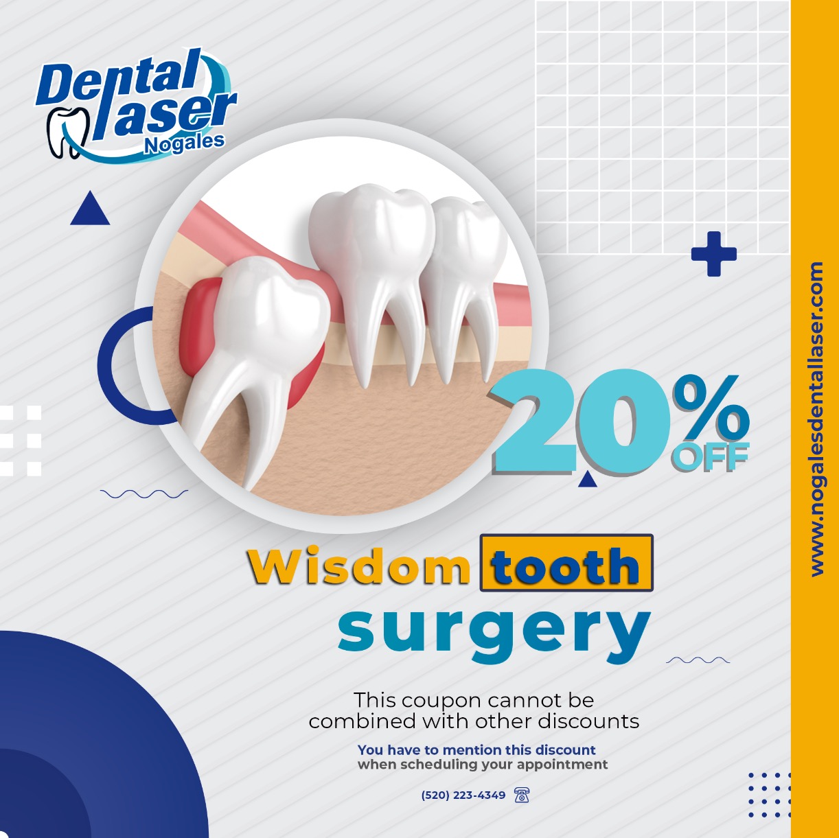 Specials Dental Laser Nogales